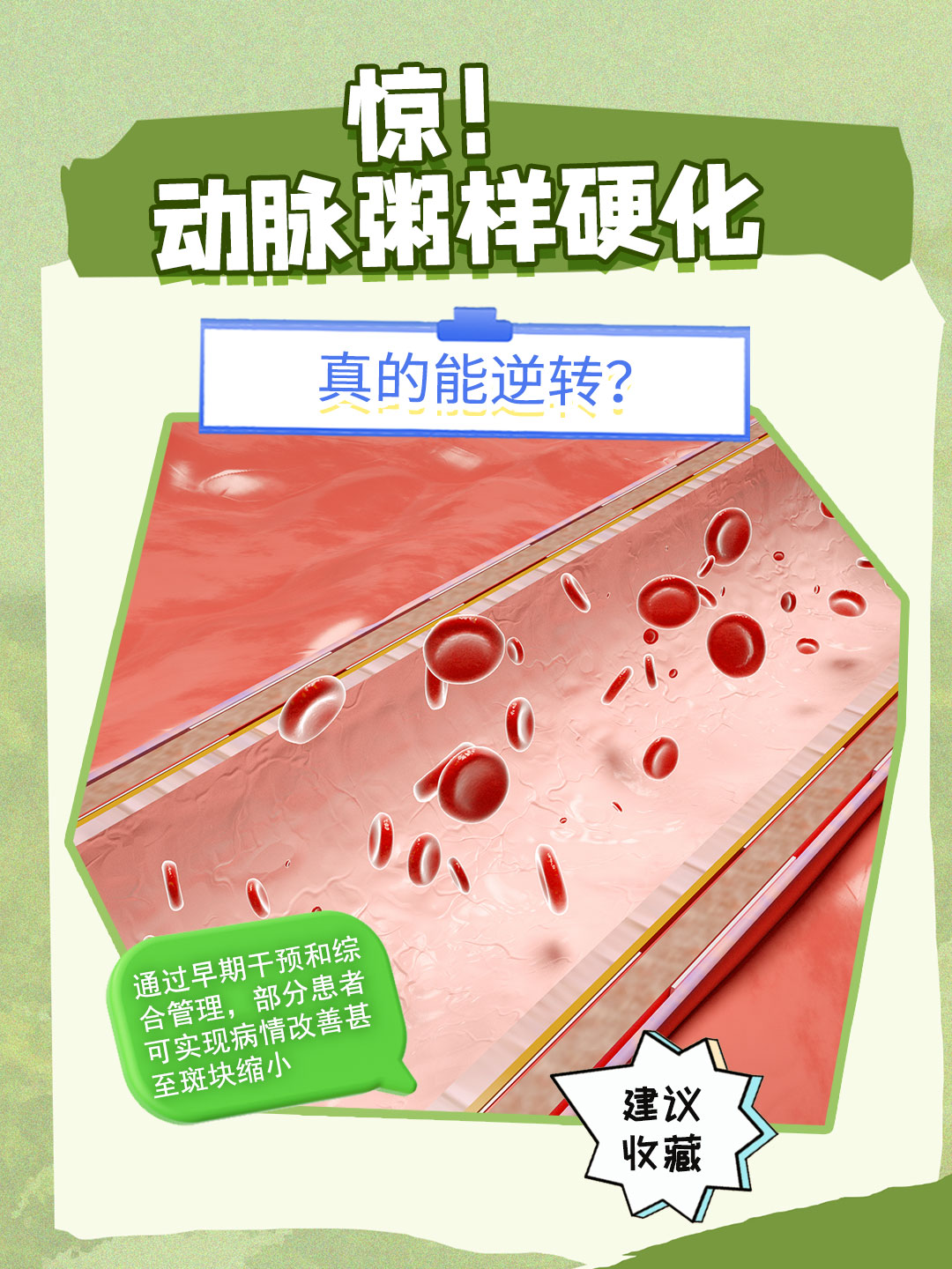 惊！动脉粥样硬化，真的能逆转？