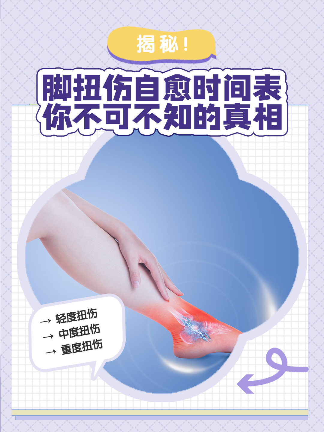 揭秘！脚扭伤自愈时间表，你不可不知的真相